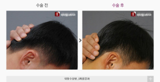 Illustration for article titled "Round Head" Plastic Surgery Seems Excessive, Even for South Korea